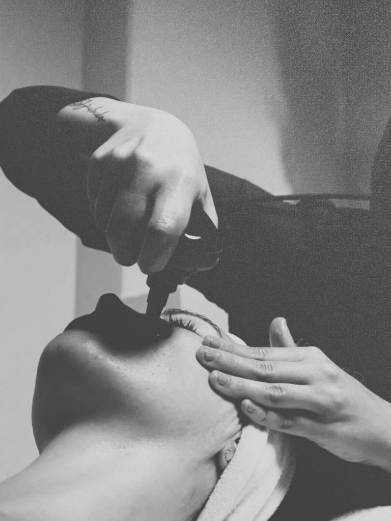 Indiba facial en Santiago de Compostela